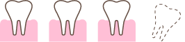 歯03