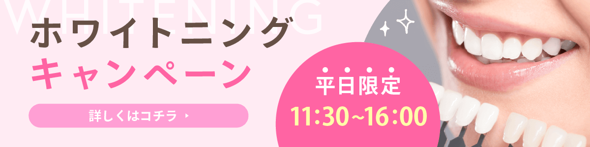 ホワイトニングキャンペーン