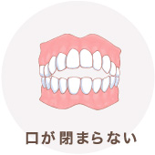 口が閉まらない