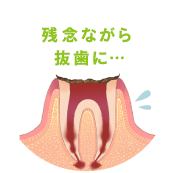 神経が死んでしまい、痛みを感じなくなります
