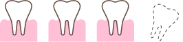 歯3