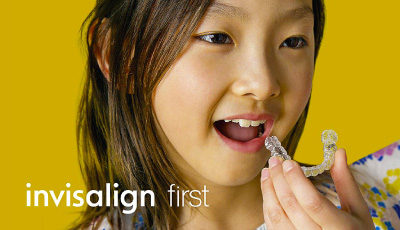 invisalign first