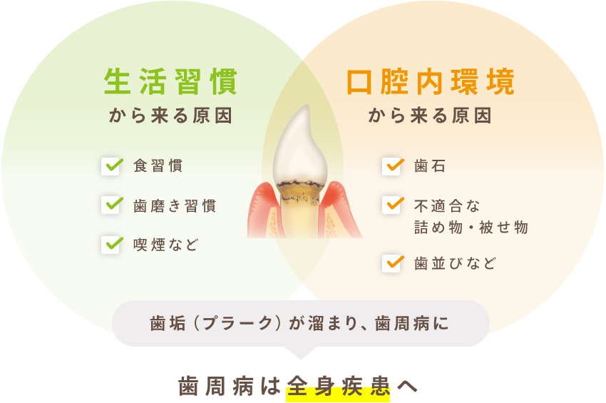 生活習慣から来る原因（食習慣・歯磨き習慣・喫煙など）＋口腔内環境から来る原因（歯石・不適合な詰め物被せ物・歯並びなど）＝歯垢が溜まり、歯周病に→歯周病は全身疾患へ