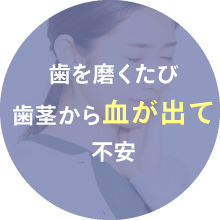 歯を磨くたび歯茎から血が出て不安