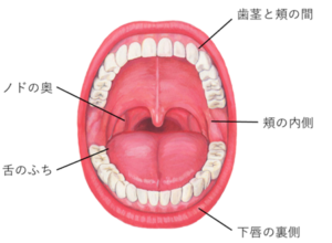 口内炎が出来る場所　お口の中　粘膜