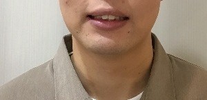 症例集　インビザライン　笑顔