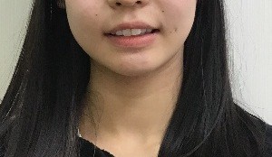 症例集　インビザライン　笑顔