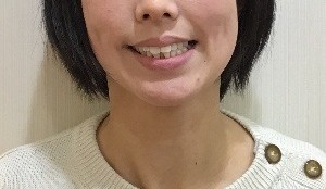 症例集 インビザライン 笑顔