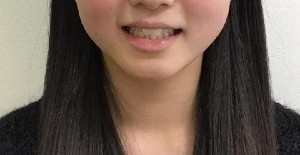 症例集　インビザライン　笑顔