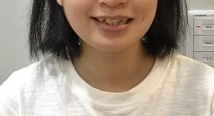 症例集　インビザライン　笑顔