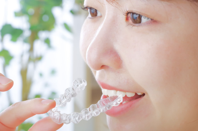 マウスピース矯正のマウスピースを装着しようとしている女性