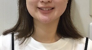 症例集　インビザライン　笑顔