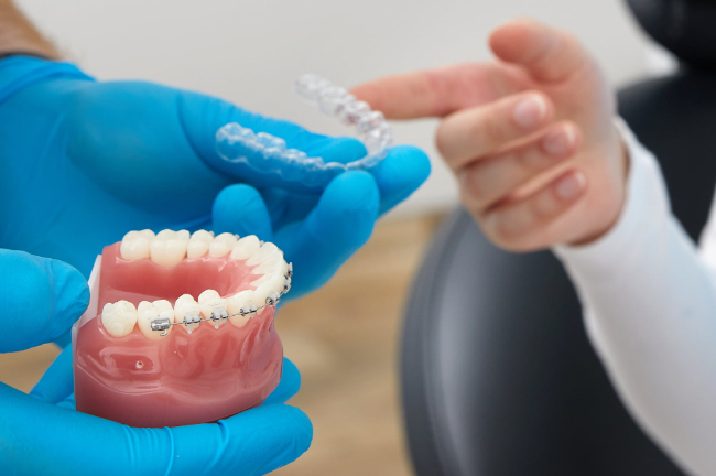 すきっ歯の矯正方法であるワイヤー矯正とマウスピース矯正について歯科医が子どもに説明しているイメージ