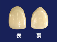 CAD/CAM冠（保険適用）
